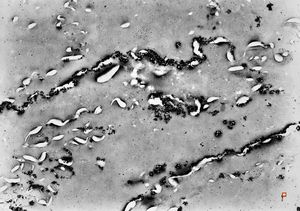 silver pigment among keratinized epidermal cells after application of silver nitrate silver pigment among keratinized epidermal cells after application of silver nitrate